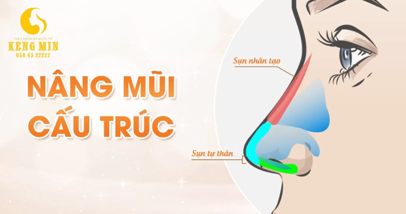 nâng mũi tự nhiên