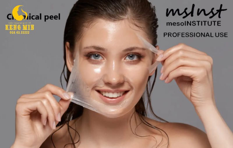 điều trị mụn ẩn tại Spa điều trị mụn ẩn tại Spa