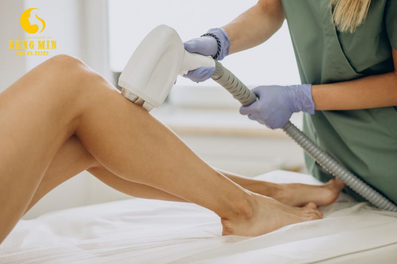Nên triệt lông chân hay không, và phương pháp triệt lông nào mang lại hiệu quả cao nhất?