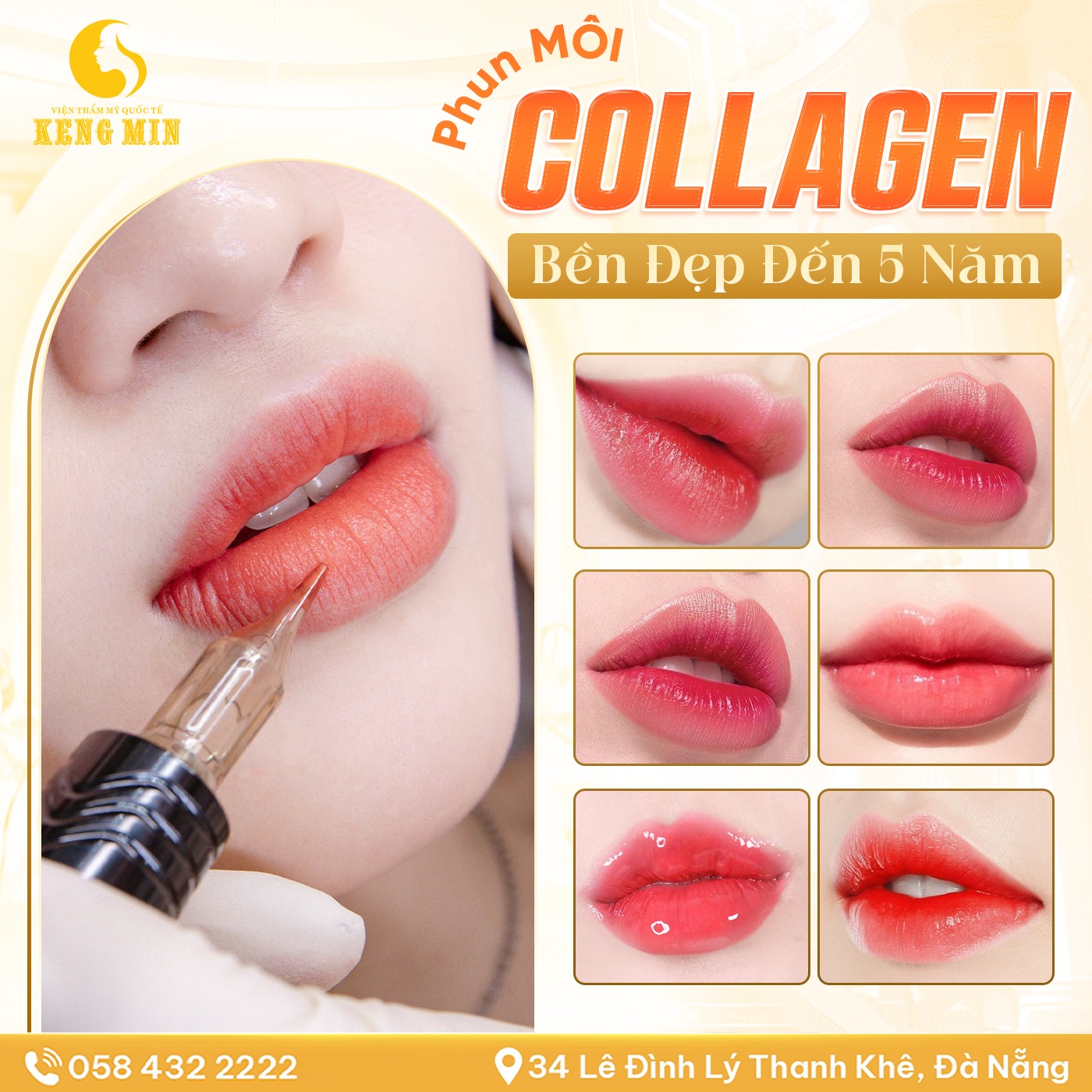 Phun Môi Collagen Nano – Giải Pháp Sở Hữu Đôi Môi Hồng Hào Bền Đẹp Đến 5 Năm