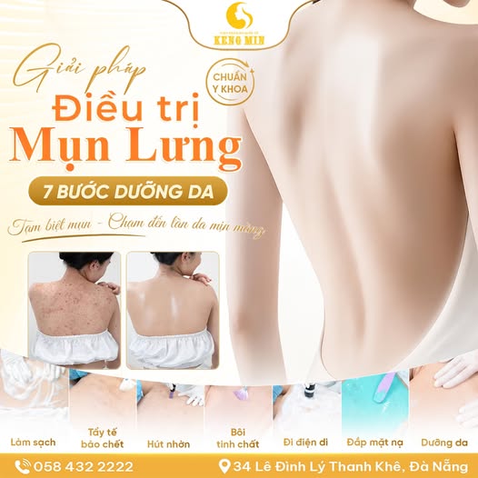 Điều Trị Mụn Lưng Chuẩn Y Khoa – Giải Pháp Cho Làn Da Lưng Sạch Mụn, Mịn Màng