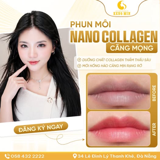 Phun Môi Nano Collagen – Bí Quyết Sở Hữu Đôi Môi Hồng Hào, Căng Mọng Tại Viện Thẩm Mỹ Quốc Tế Keng Min
