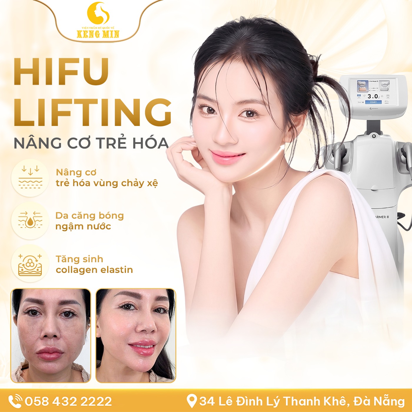 HIFU Lifting – Nâng cơ trẻ hóa, da căng bóng & săn chắc tại Đà Nẵng