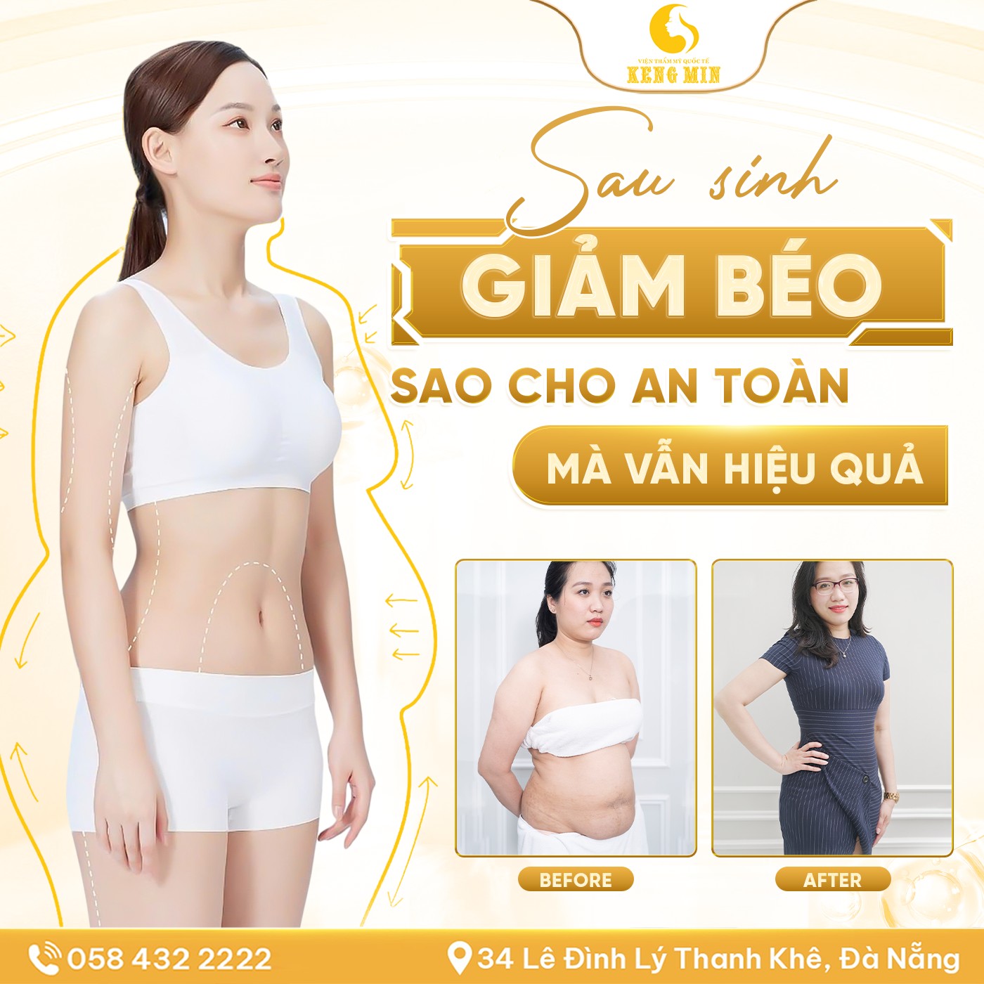 Sau Sinh Giảm Béo Sao Cho An Toàn Mà Vẫn Hiệu Quả?