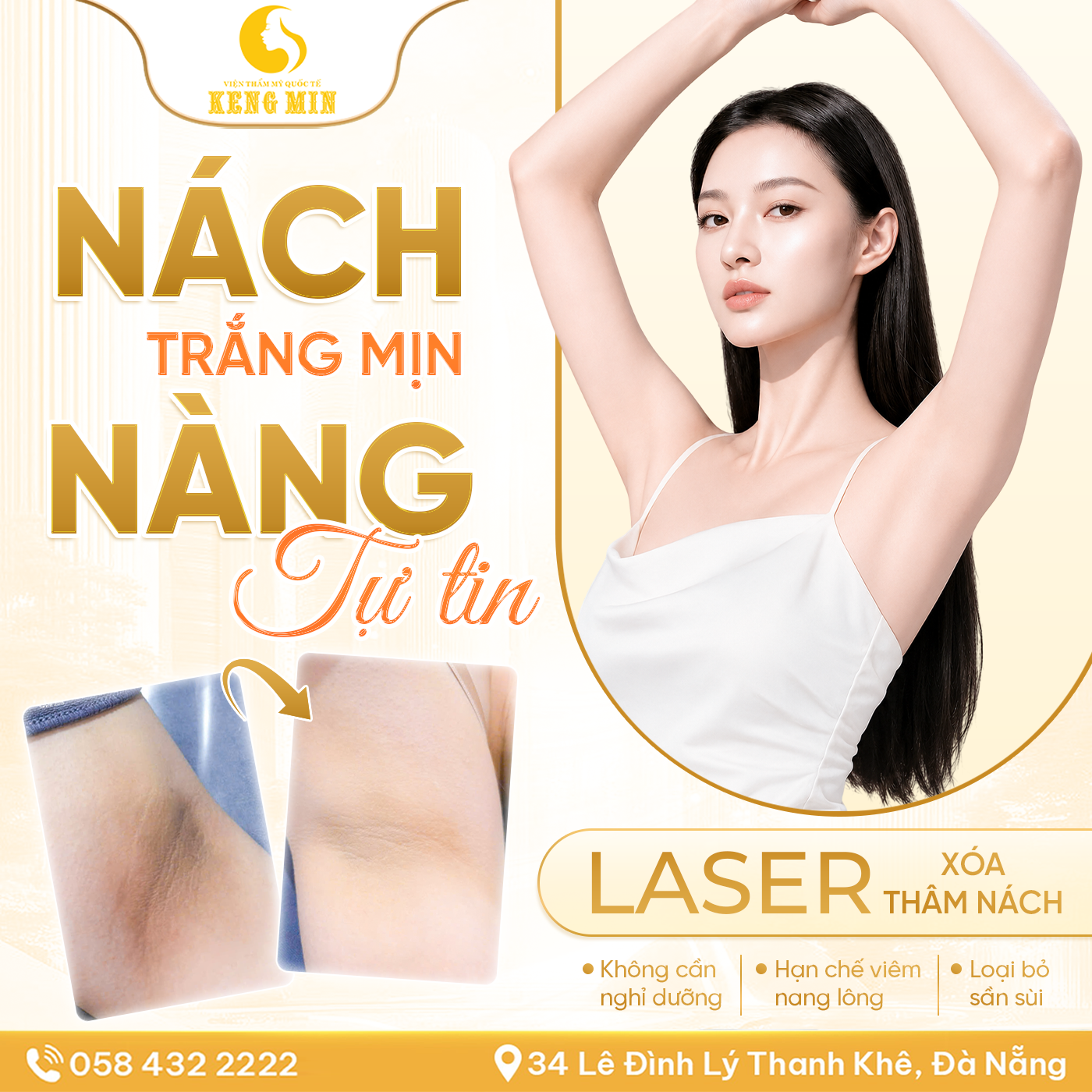 XÓA THÂM NÁCH BẰNG LASER – GIẢI PHÁP GIÚP DA SÁNG MỊN, TỰ TIN DIỆN MỌI TRANG PHỤC