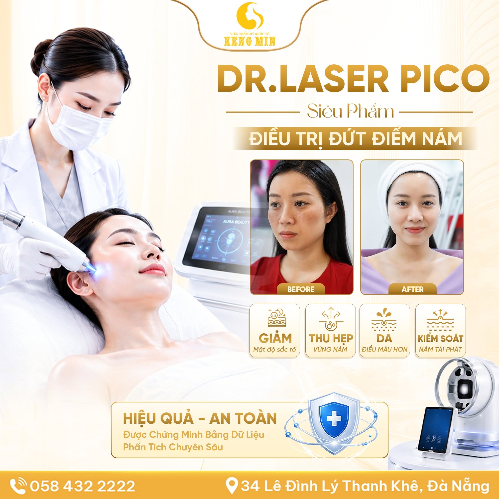 DR. LASER PICO – GIẢI PHÁP ĐIỀU TRỊ NÁM HIỆN ĐẠI GIÚP LẤY LẠI LÀN DA SÁNG KHỎE