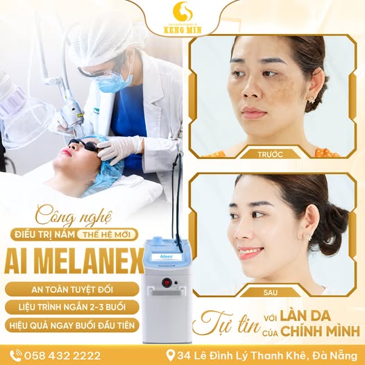 CÔNG NGHỆ ĐIỀU TRỊ NÁM THẾ HỆ MỚI AI MELANEX – GIẢI PHÁP CHUYÊN SÂU CHO LÀN DA SÁNG KHỎE
