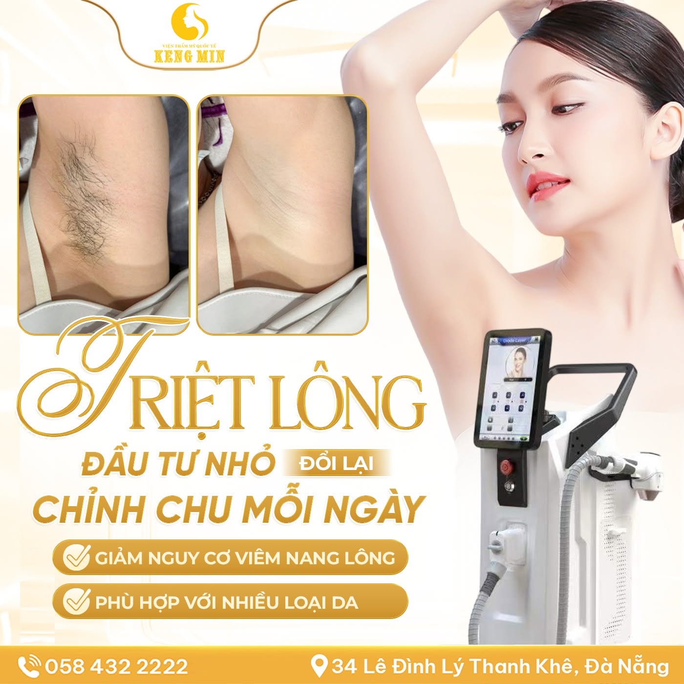Triệt Lông Công Nghệ Cao – Giải Pháp Loại Bỏ Lông Hiệu Quả, An Toàn Và Tiết Kiệm Thời Gian