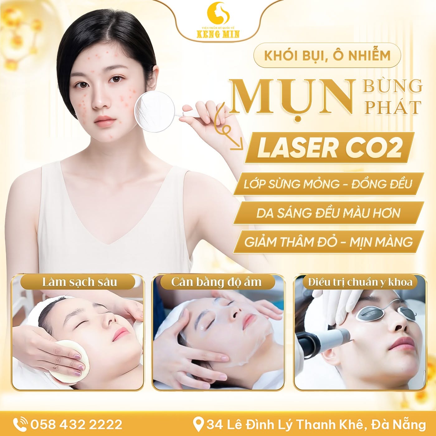 ĐIỀU TRỊ MỤN BẰNG LASER CO2 FRACTIONAL – GIẢI PHÁP CHUẨN Y KHOA CHO LÀN DA SẠCH MỤN, MỊN MÀNG