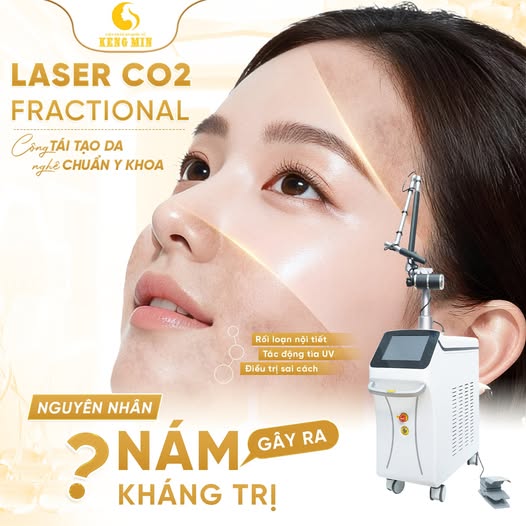 LASER CO2 FRACTIONAL – GIẢI PHÁP HỖ TRỢ ĐIỀU TRỊ NÁM, TÀN NHANG VÀ TÁI TẠO DA CHUẨN Y KHOA