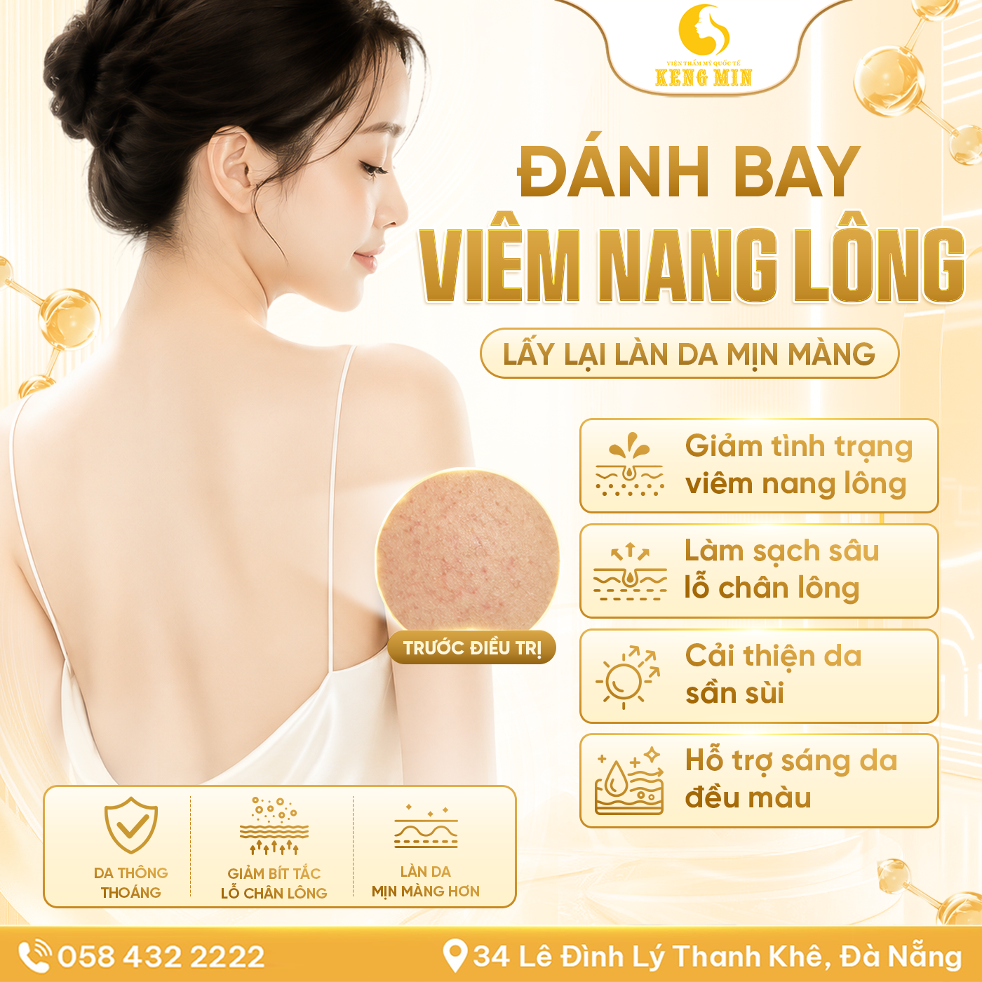 ĐIỀU TRỊ VIÊM NANG LÔNG HIỆU QUẢ – LẤY LẠI LÀN DA MỊN MÀNG TẠI VIỆN THẨM MỸ QUỐC TẾ KENG MIN
