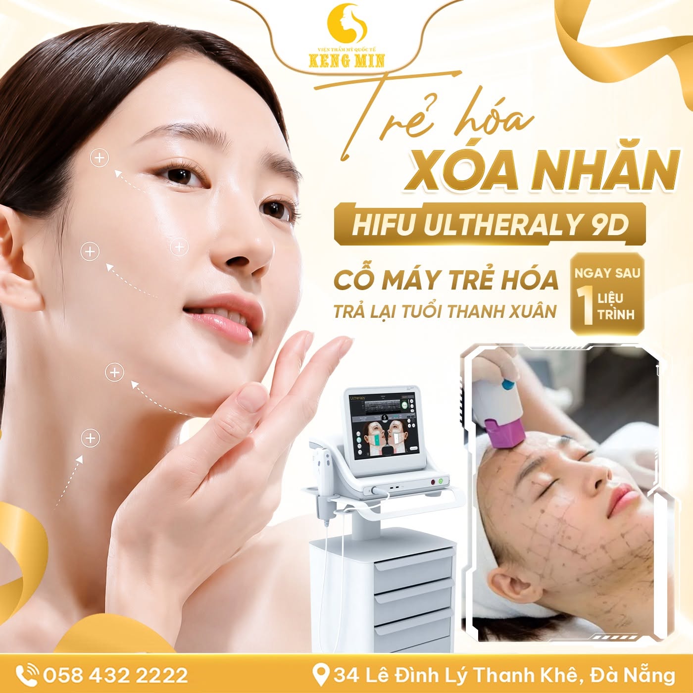 HIFU ULTHERALY 9D – GIẢI PHÁP NÂNG CƠ, TRẺ HÓA DA KHÔNG PHẪU THUẬT TẠI VIỆN THẨM MỸ QUỐC TẾ KENG MIN