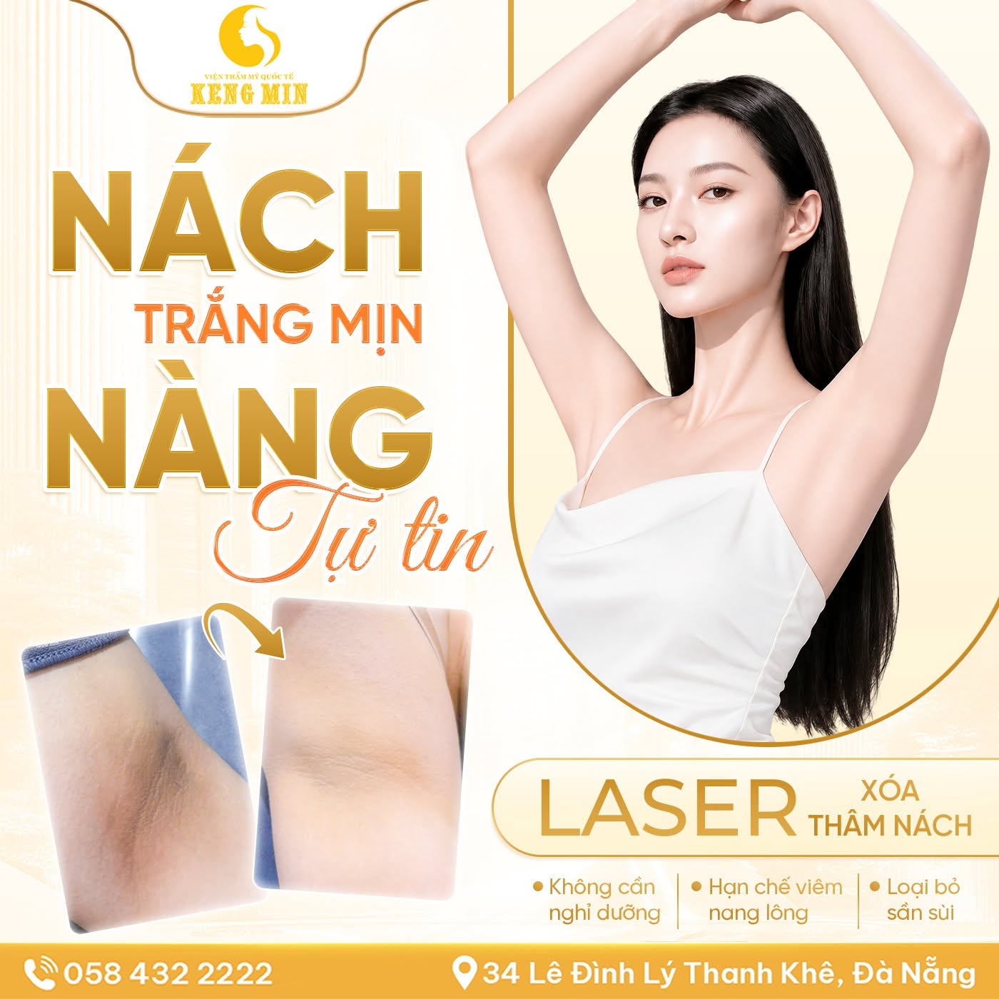 XÓA THÂM NÁCH BẰNG LASER – GIẢI PHÁP LẤY LẠI LÀN DA TRẮNG MỊN, TỰ TIN DIỆN MỌI TRANG PHỤC