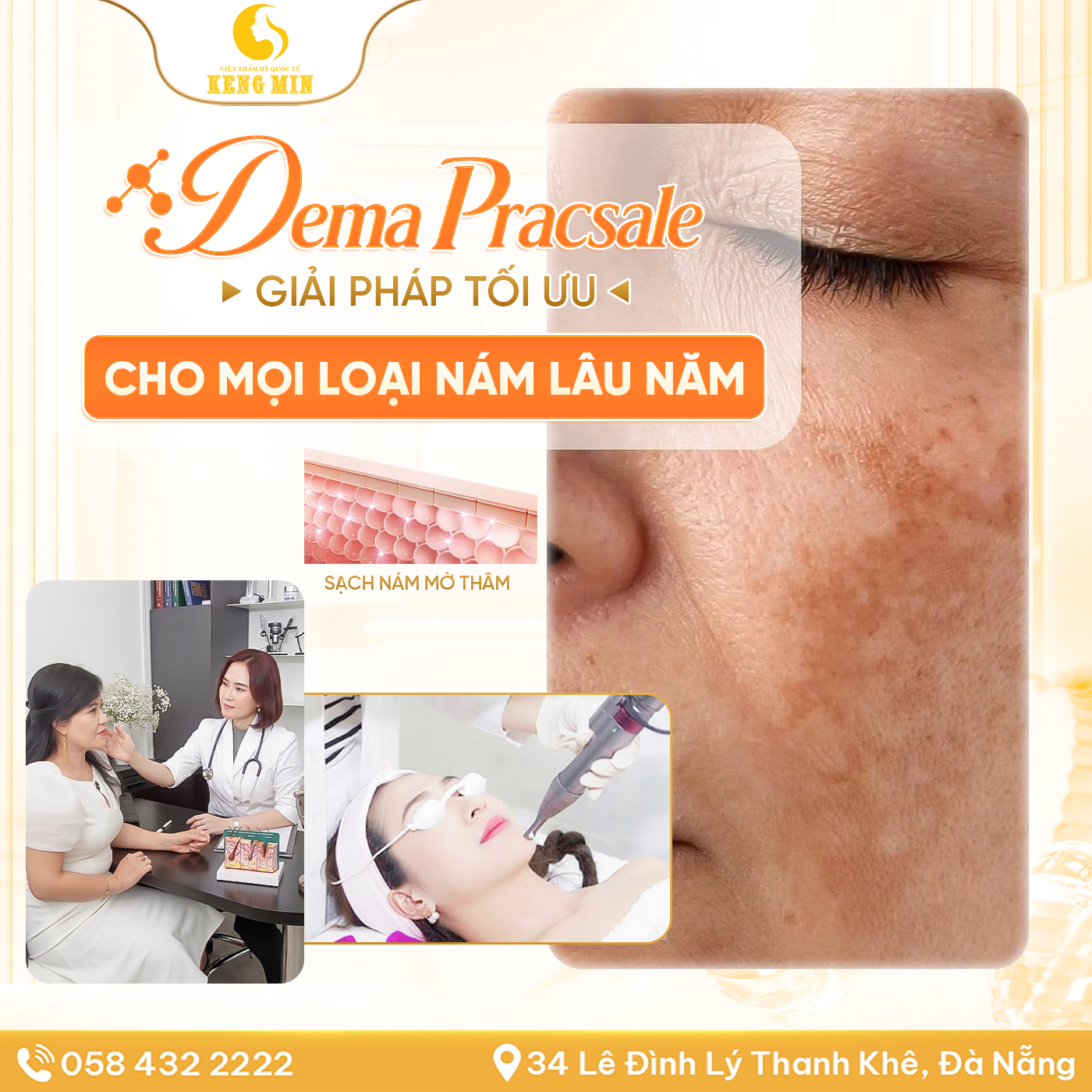 ĐIỀU TRỊ NÁM DEMA PRACSALE – GIẢI PHÁP HỖ TRỢ CẢI THIỆN NÁM CHUYÊN SÂU CHO LÀN DA SÁNG KHỎE