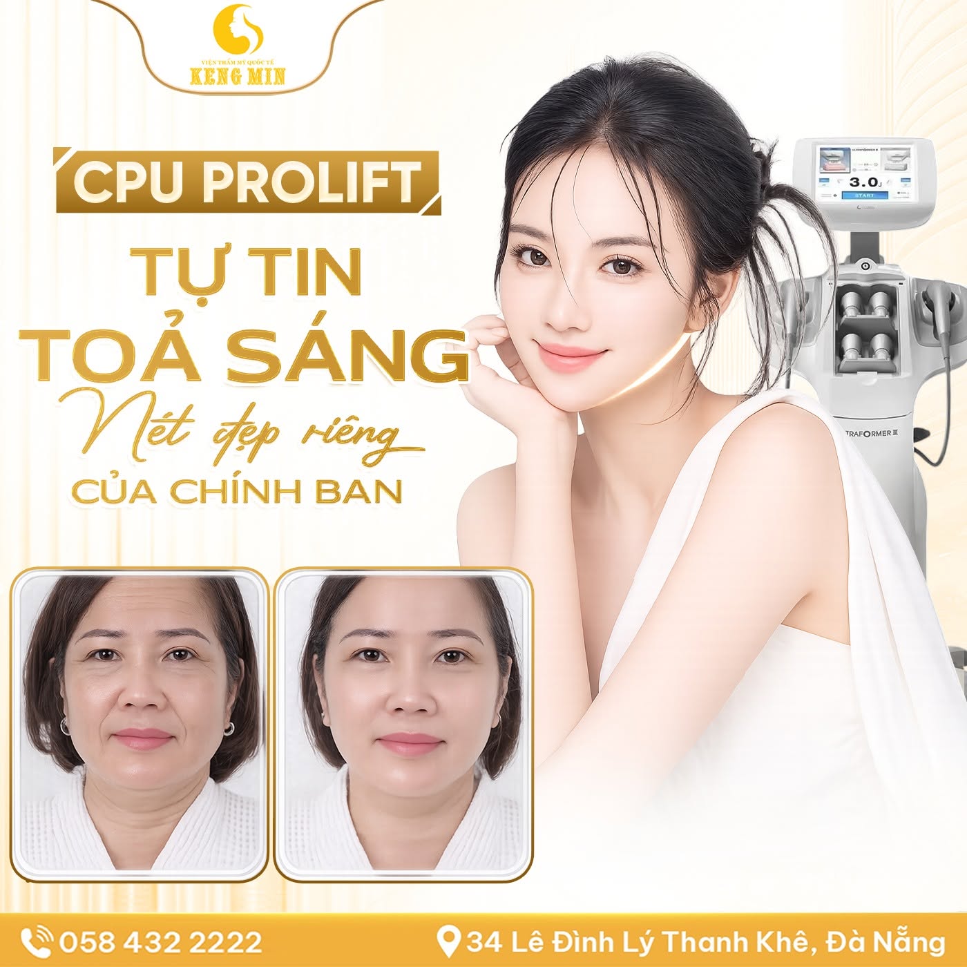 CPU Prolift – Giải Pháp Nâng Cơ, Săn Chắc Da Và Hỗ Trợ Trẻ Hóa Gương Mặt