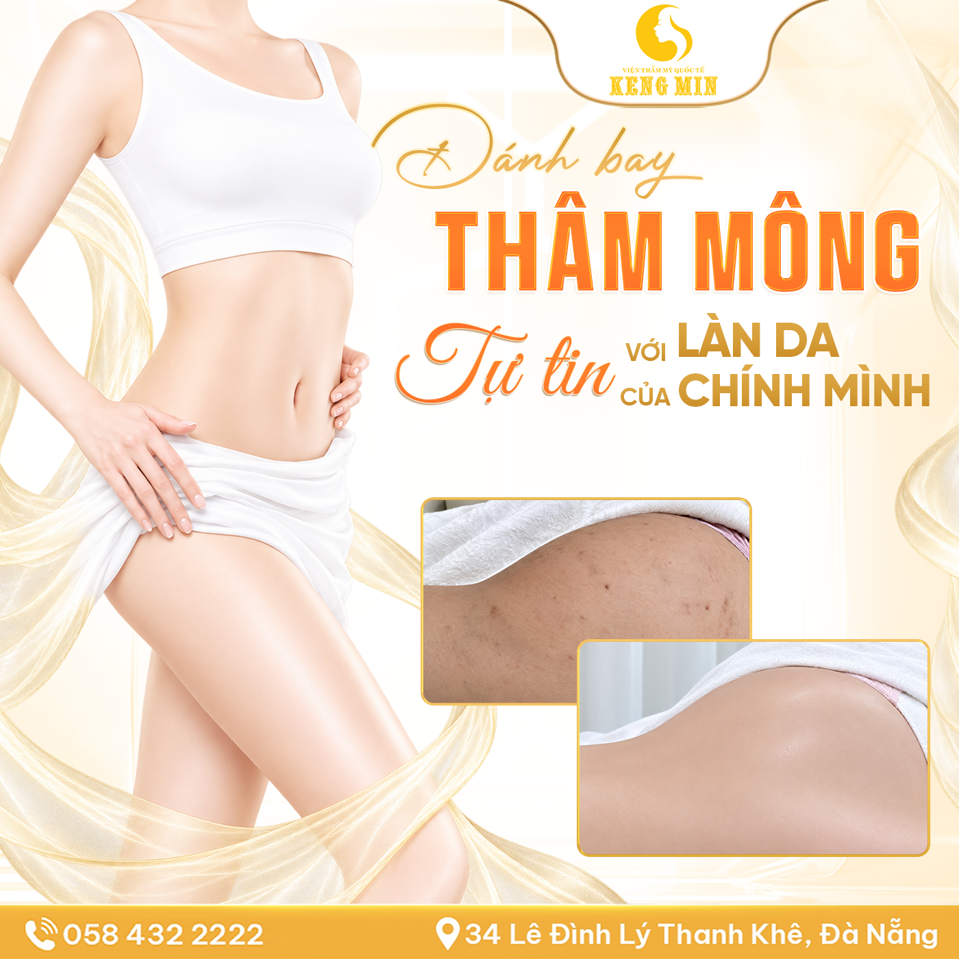 ĐÁNH BAY THÂM MÔNG – GIẢI PHÁP HỖ TRỢ CẢI THIỆN SẮC TỐ, CHO LÀN DA MỊN MÀNG VÀ ĐỀU MÀU HƠN