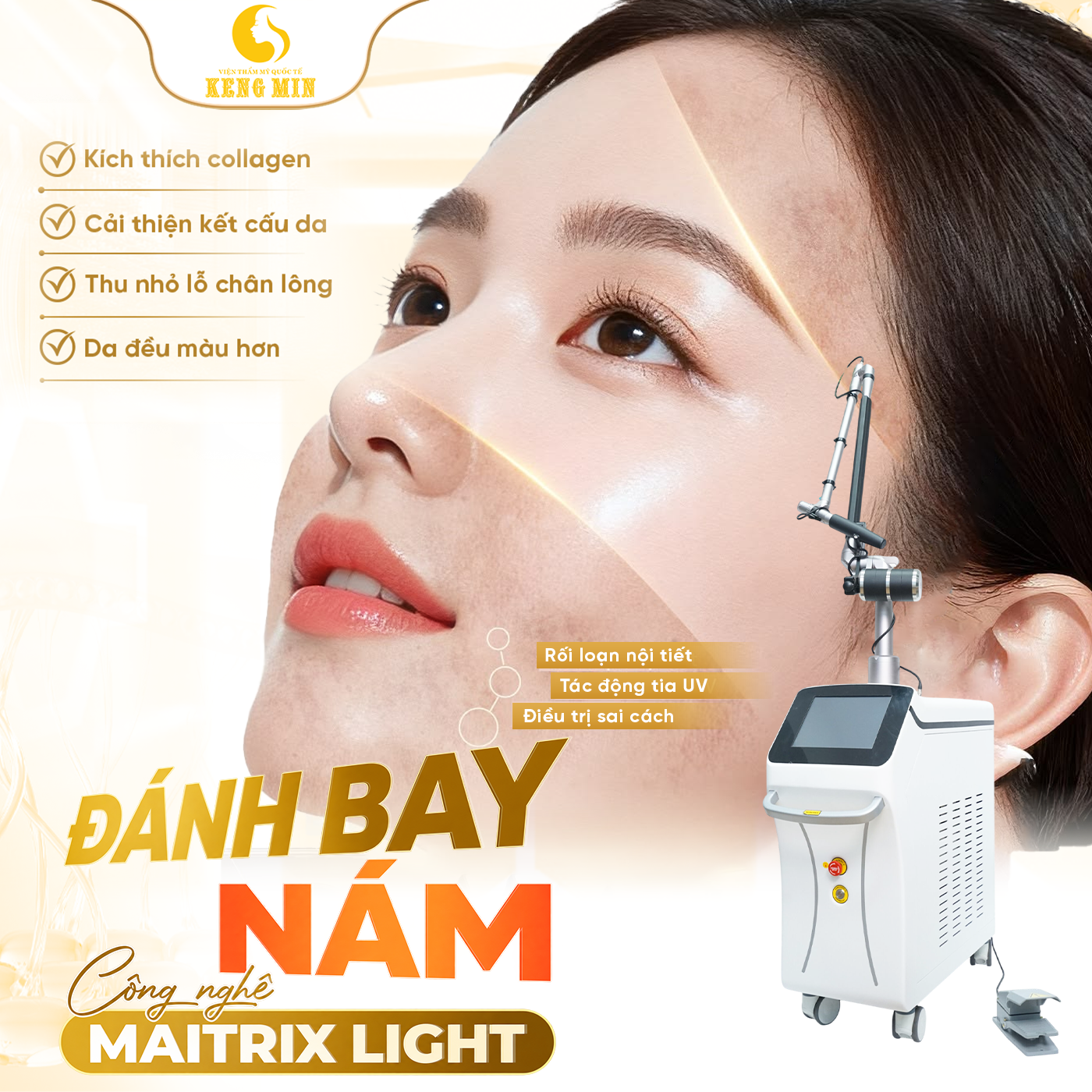 Điều Trị Nám Bằng Công Nghệ Matrix Light – Hỗ Trợ Cải Thiện Sắc Tố, Cho Làn Da Đều Màu Hơn