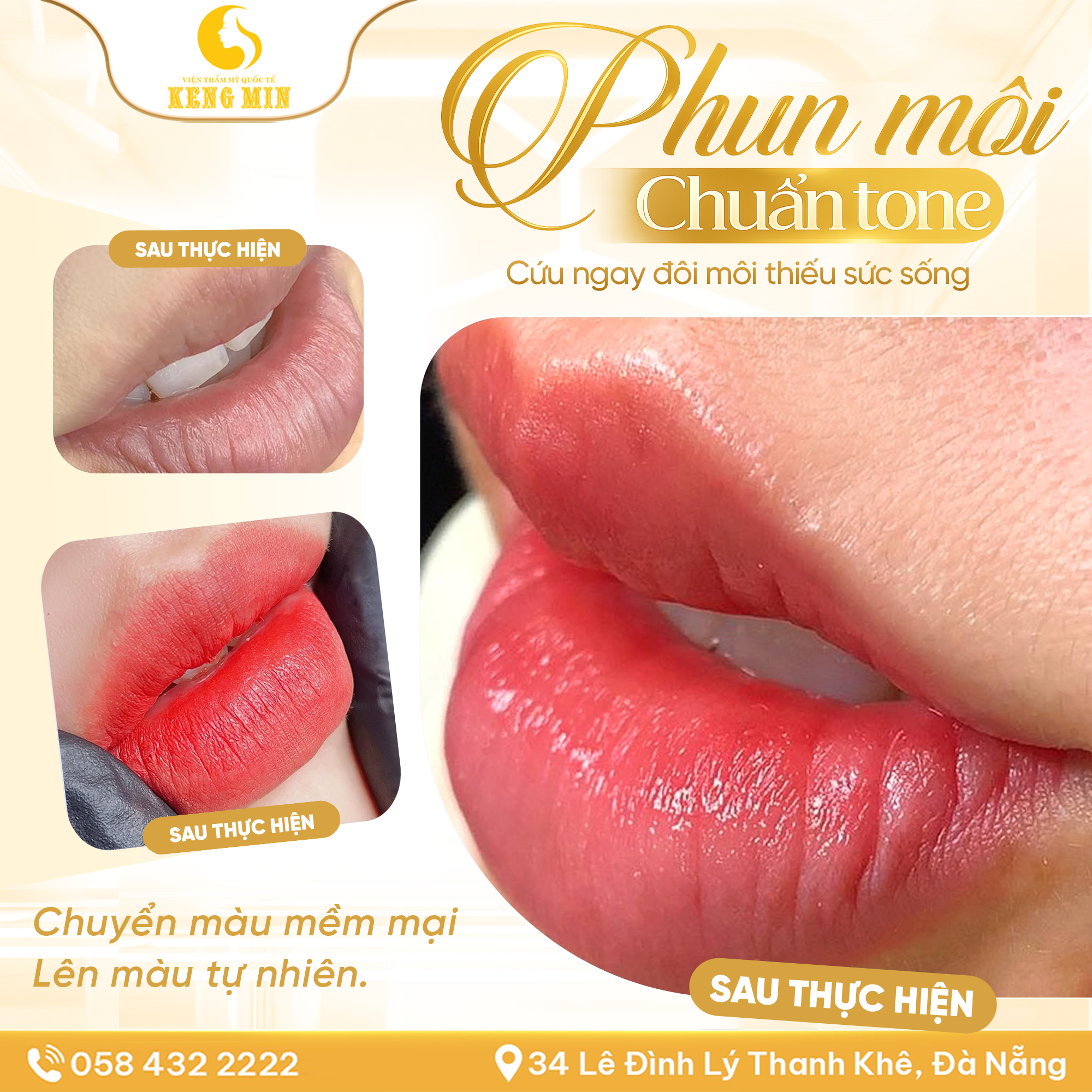 Phun Môi Chuẩn Tone – Giải Pháp Hỗ Trợ Cải Thiện Sắc Môi, Cho Đôi Môi Tươi Tắn Và Tự Nhiên Hơn