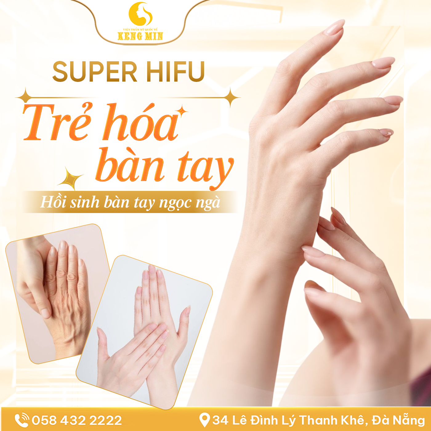 SUPER HIFU TRẺ HÓA BÀN TAY – GIẢI PHÁP HỖ TRỢ CẢI THIỆN DA TAY KHÔ NHĂN, KÉM SĂN CHẮC