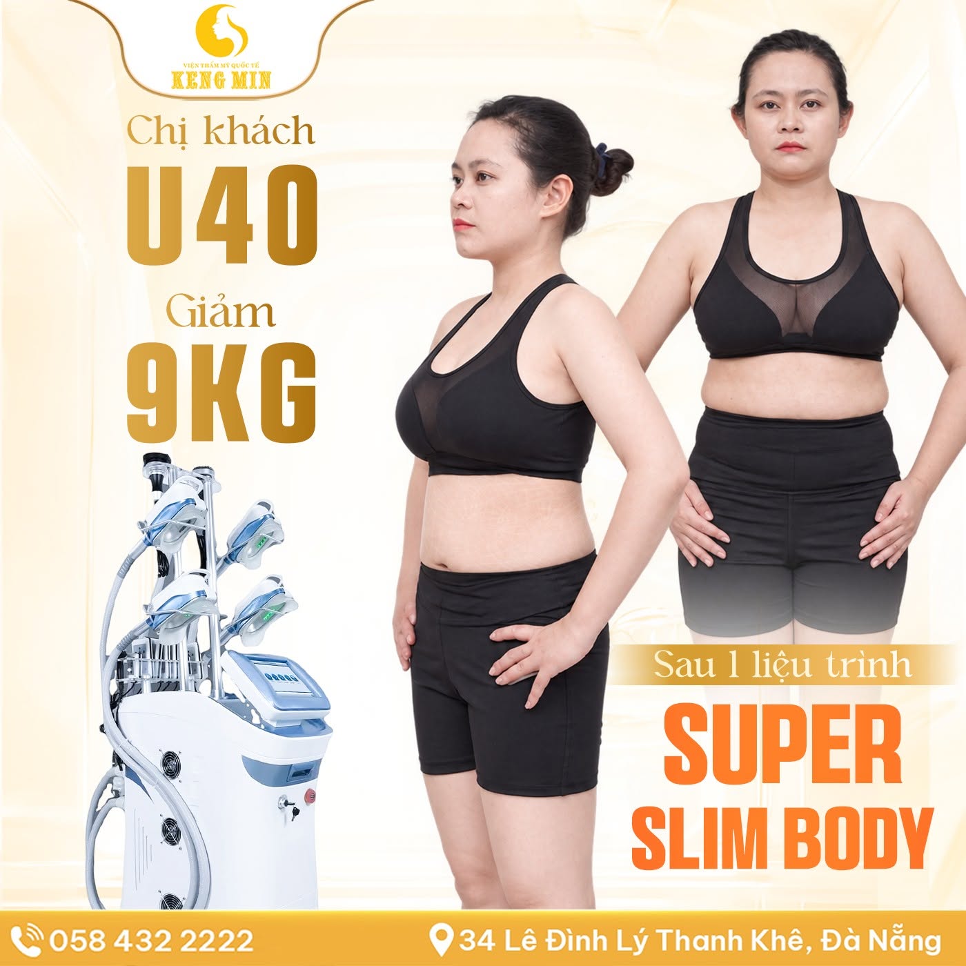 Super Slim Body – Giải Pháp Hỗ Trợ Giảm Mỡ, Cải Thiện Vóc Dáng Tại Đà Nẵng