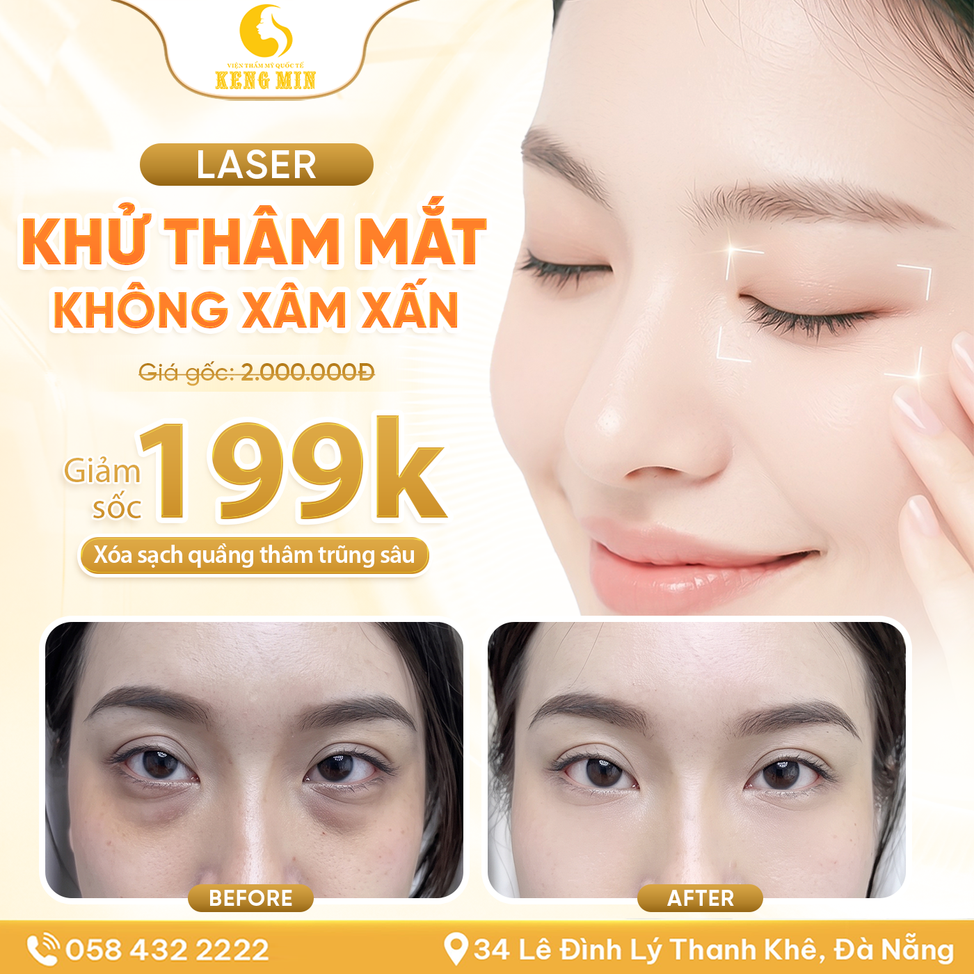 NÁM LÂU NĂM – NGUYÊN NHÂN, CÁCH ĐIỀU TRỊ VÀ GIẢI PHÁP HỖ TRỢ CẢI THIỆN SẮC TỐ TẠI KENG MIN