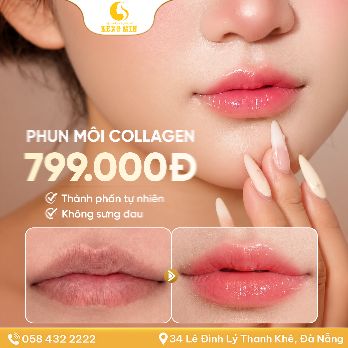 SE KHÍT DA VI ĐIỂM – GIẢI PHÁP HỖ TRỢ CẢI THIỆN LỖ CHÂN LÔNG, CHO LÀN DA LÁNG MỊN HƠN